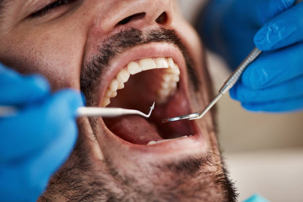 Best Orthodontic Emergency Dentist in Mount Angel, OR